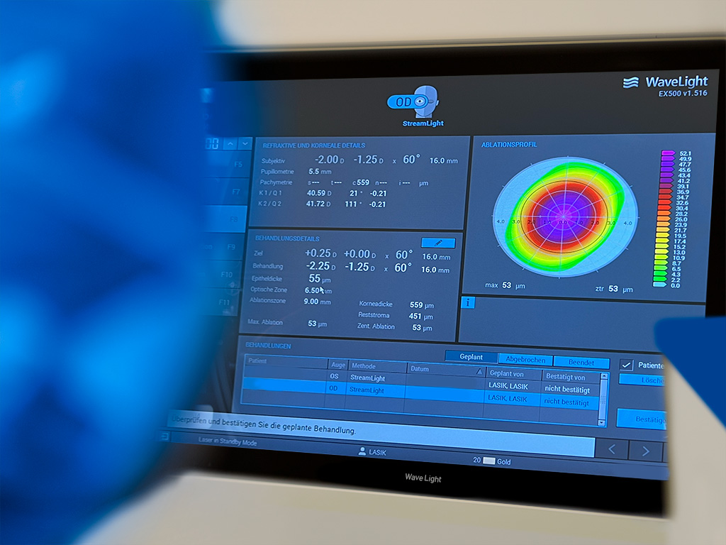 Bildschirm eines Wavelight-ES500-Lasers